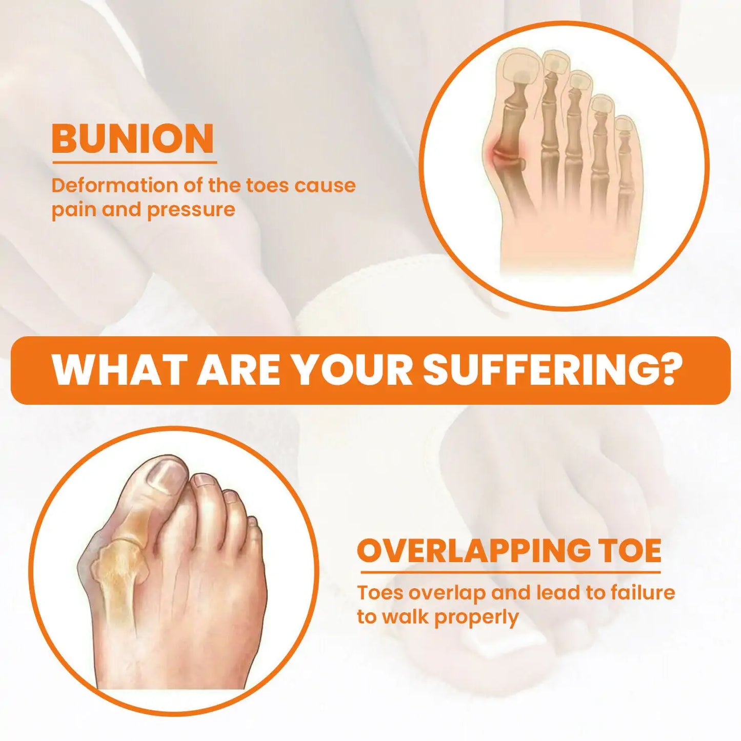 Splint Big Toe Straightener